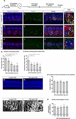 Insulin-Like Growth Factor 1 on the Maintenance of Ribbon Synapses in Mouse Cochlear Explant Cultures